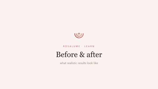 LED Face Mask Before and After: What Realistic Results Actually Look Like — Rosalume Learn